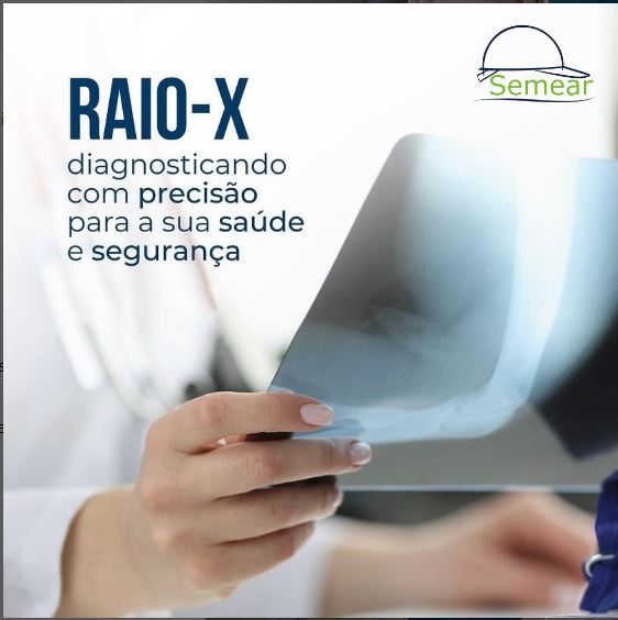 Exame de Raio-X